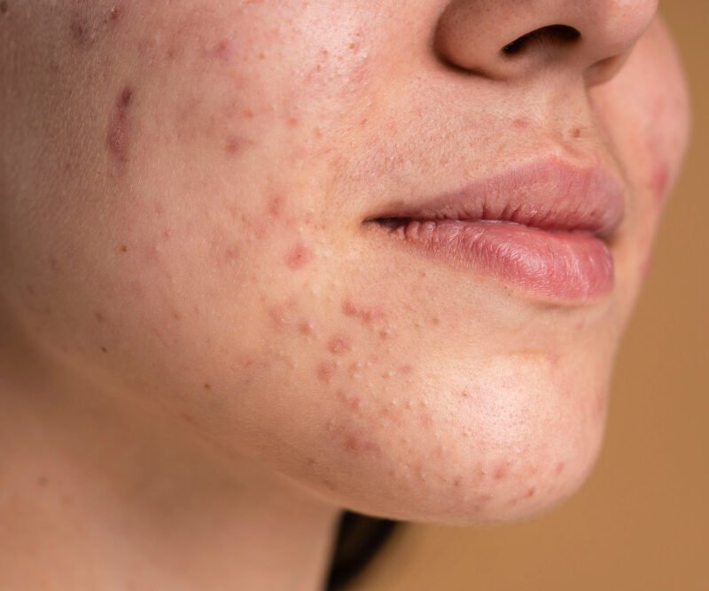 Read more about the article Face Scars: Causes and How to Minimize Them
