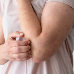 Why Your Skin Is Itchy: 9 Common Causes