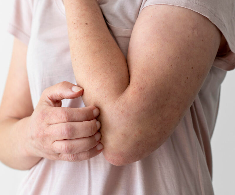 You are currently viewing Why Your Skin Is Itchy: 9 Common Causes