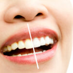 9 Tips for Whiter Teeth That Really Work